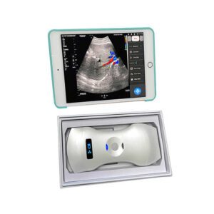 3 in 1 Convex&Phased+Linear/Transvaginal Wireless Medical Portable Ultrasound Doppler for Cardiac Examination