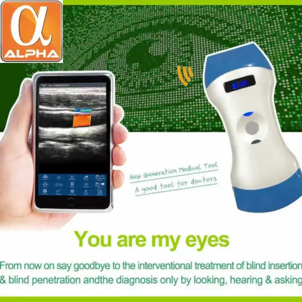 Hospital Clinic Use  Wireless Portable Handheld Ultrasound Probe - Image 4