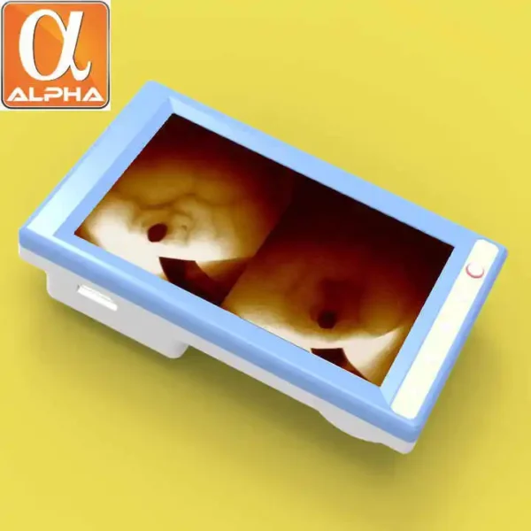 Hospital Using Hot Sale Potable Handheld LCD Screen Rechargeable Detector Infrared Vein Finder - Image 2