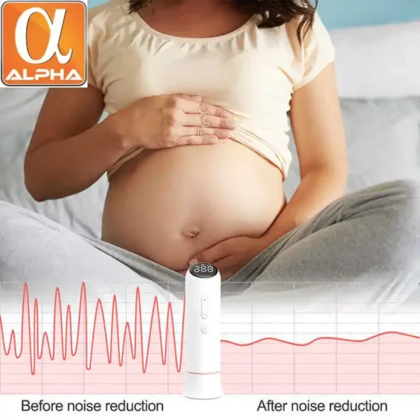 Hotsale Cheap Price Wireless Free App Heart Rate Baby Heartbeat Monitor Fetal Doppler - Image 2