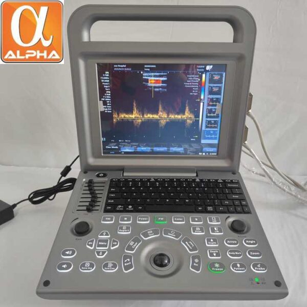 Medical Portable 3D Full Digital Color Doppler Ultrasound Echocardiography Machine Portable Ultrasound Scanner - Image 3