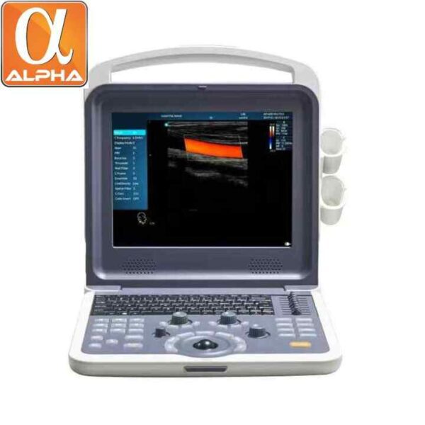 Medical Portable 4d Full Digital Color Doppler B Ultrasound Scanner Machine - Image 3