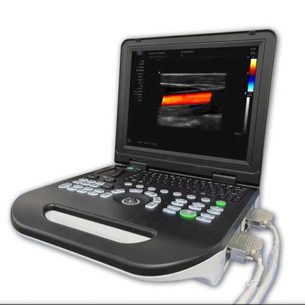 Medical Portable Notebook 3D Full Digital Color Doppler Ultrasound Echocardiography Machine Portable Ultrasound Scanner - Image 2
