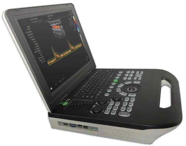 Medical Portable Notebook 3D Full Digital Color Doppler Ultrasound Echocardiography Machine Portable Ultrasound Scanner - Image 4
