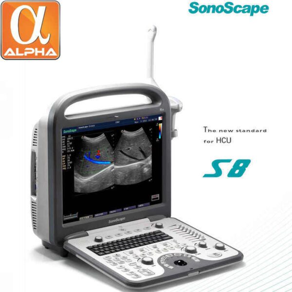 Medical Sonoscape S8 Portable 4d Color Doppler Ultrasound - Image 4