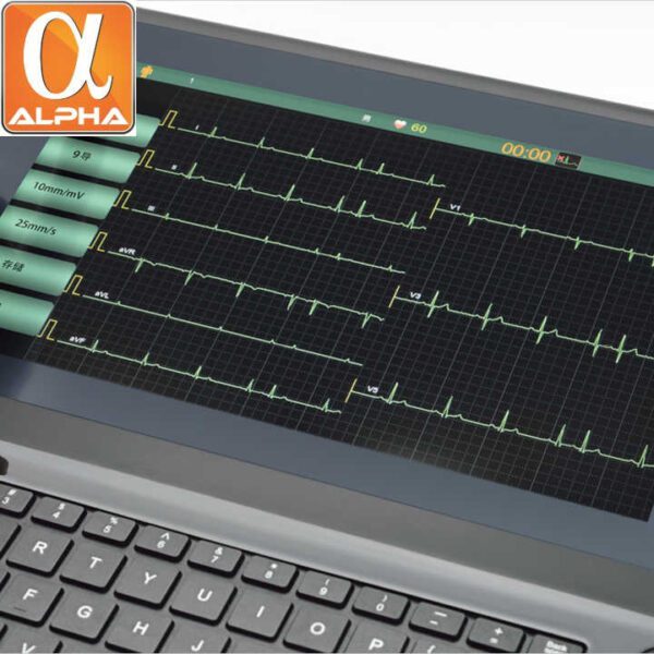 Medical Touch Screen 12 Channels Digital Portable ECG Machine - Image 3