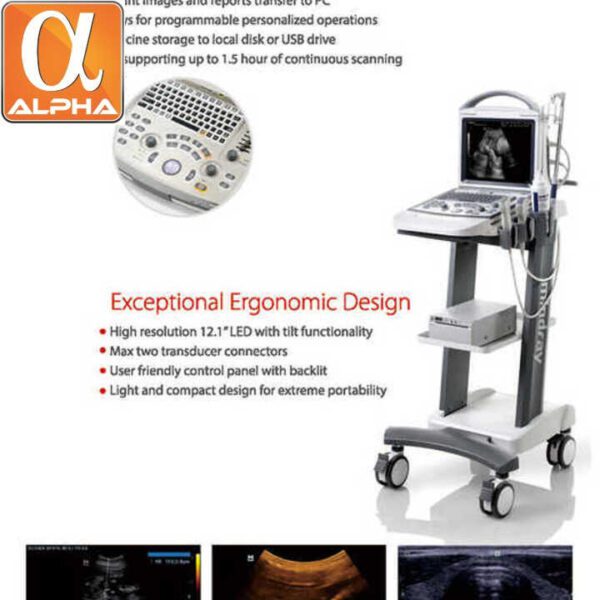 Mindray DP-30 4d Ultrasound Portable Laptop Doppler Ultrasound Scanner - Image 6