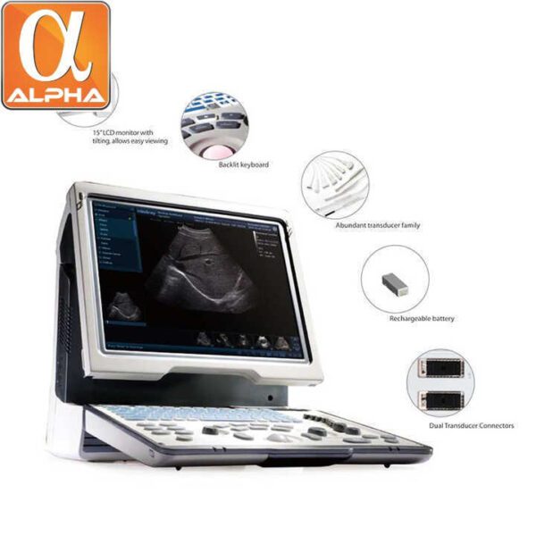 Mindray DP50 Portable Color Ultrasound Doppler Ultrasound Machine for Medical - Image 4