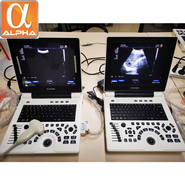 PU33A Ultrasound Portable Laptop Doppler Ultrasound Scanner - Image 4