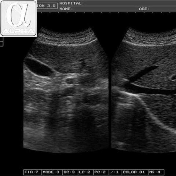 PU33A Ultrasound Portable Laptop Doppler Ultrasound Scanner - Image 5