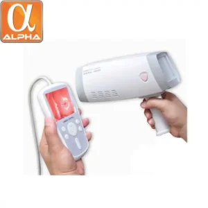 Portable Digital Colposcope Camera Mini Gynecology Video Colposcope LED Video Display Electronic Colposcope