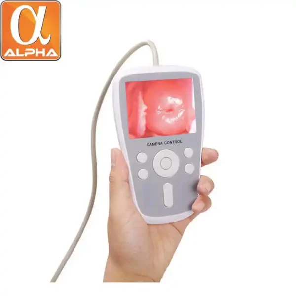 Portable Digital Colposcope Camera Mini Gynecology Video Colposcope LED Video Display Electronic Colposcope - Image 2