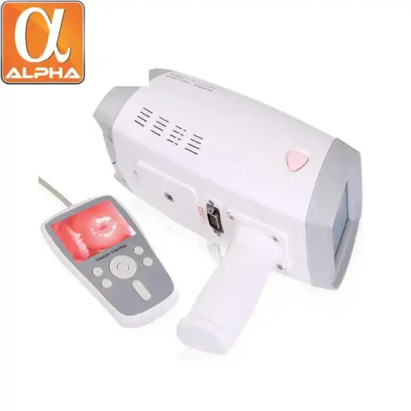 Portable Digital Colposcope Camera Mini Gynecology Video Colposcope LED Video Display Electronic Colposcope - Image 5