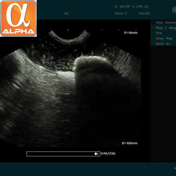 Portable Edan Ultrasound Machine Black and White Ultrasound Machines - Image 4