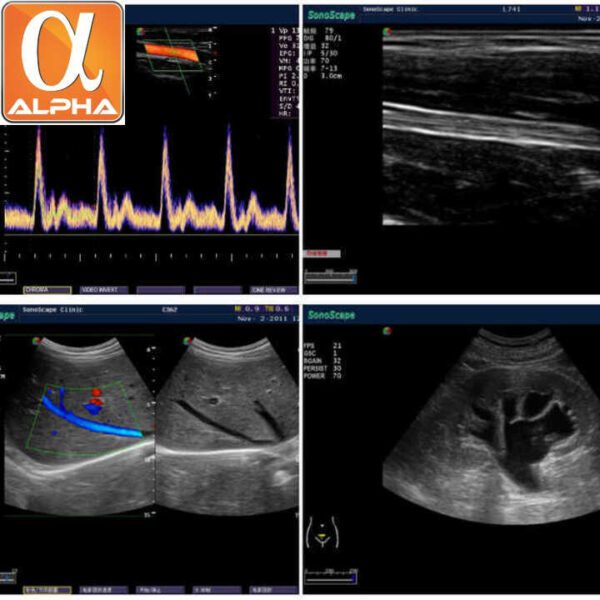 Portable Sonoscape S11 Plus Ultrasound Scanner Trolley Ultrasound for Medical - Image 6