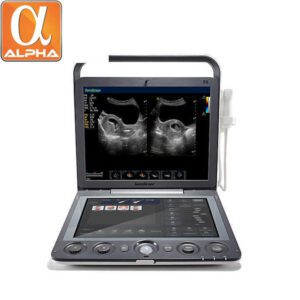 Sonoscape E2v Portable  Veterinary Ultrasound