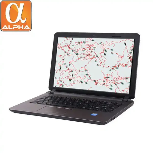 Wholesale Factory Instrument Veterinary Semen Analyzer Equipment Veterinary Trolley Sperm Analyzer Price Vet Use Sperm Analyzer - Image 2