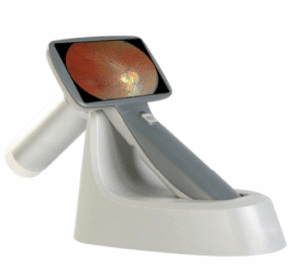 Hand-Held Fundus Camera