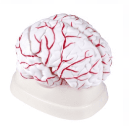 Cerebral Artery Model
